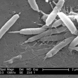 Helicobacter pylori (Хеликобактер пилори) туралы не білу керек?