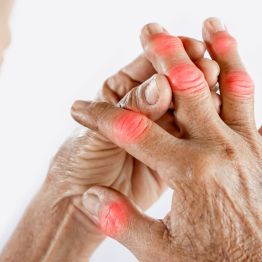 Ревматоидный артрит − когда иммунитет работает против вас