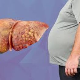 Бауырдың майлы ауруы: бауырды «май басқанда» не істеу керек