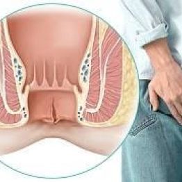 Анальды жарық: нәзік мәселені қалай шешуге болады