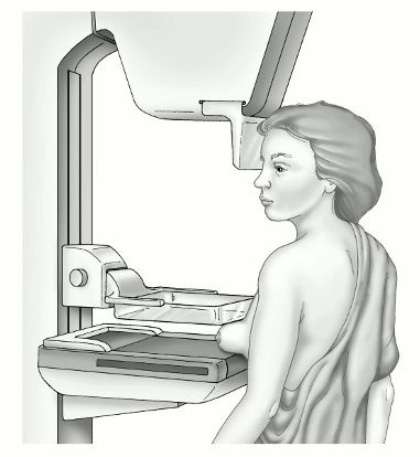 Mamografia